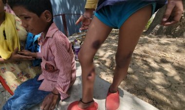 पटना में स्कूली शिक्षक बना जल्लाद, चम्मच गर्म कर दो छात्रों को बेरहमी से दागा