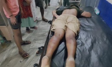 नवादा में बाइक चोरी का आरोप लगाकर दो युवकों को बंधक बनाकर पीटा, जख्मी युवकों का सदर अस्पताल में चल रहा है इलाज
