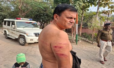 नवादा में मुखिया की दबंगई : रोजगार सेवक के साथ किया बेरहमी से पिटाई, प्राथमिकी दर्ज