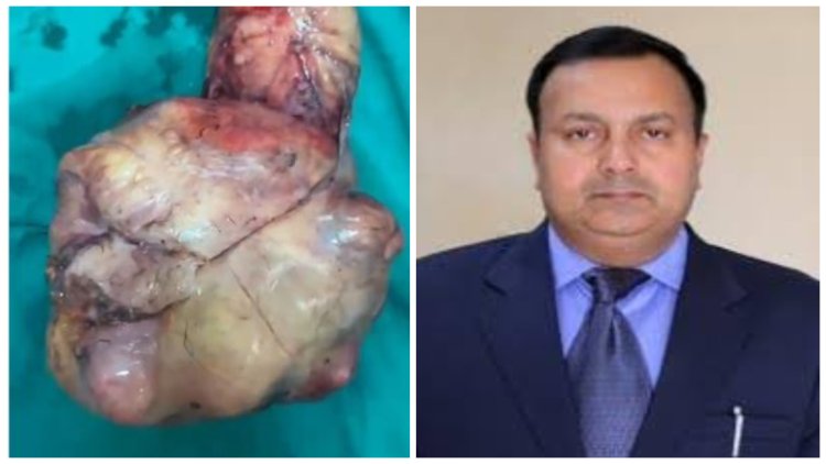 IGIMS में मरीज के पेट से निकला आठ किलो का दुर्लभ ट्यूमर, डॉ. मनीष मंडल ने अधेड़ को दिया नया जीवन